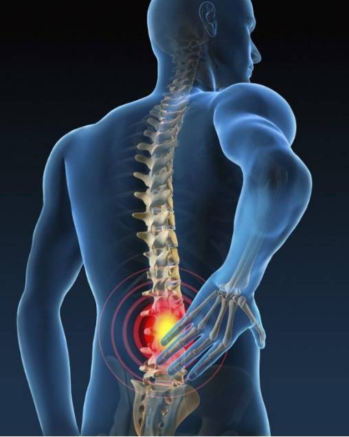 皇冠信用盘是什么意思_杏师堂透骨膏:腰椎间盘突出是什么意思