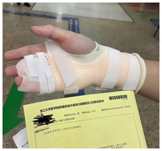 皇冠信用网押金多少_“杭州讨饭的狗”事件深思:刺痛多少打工人皇冠信用网押金多少,心疼的不是100押金