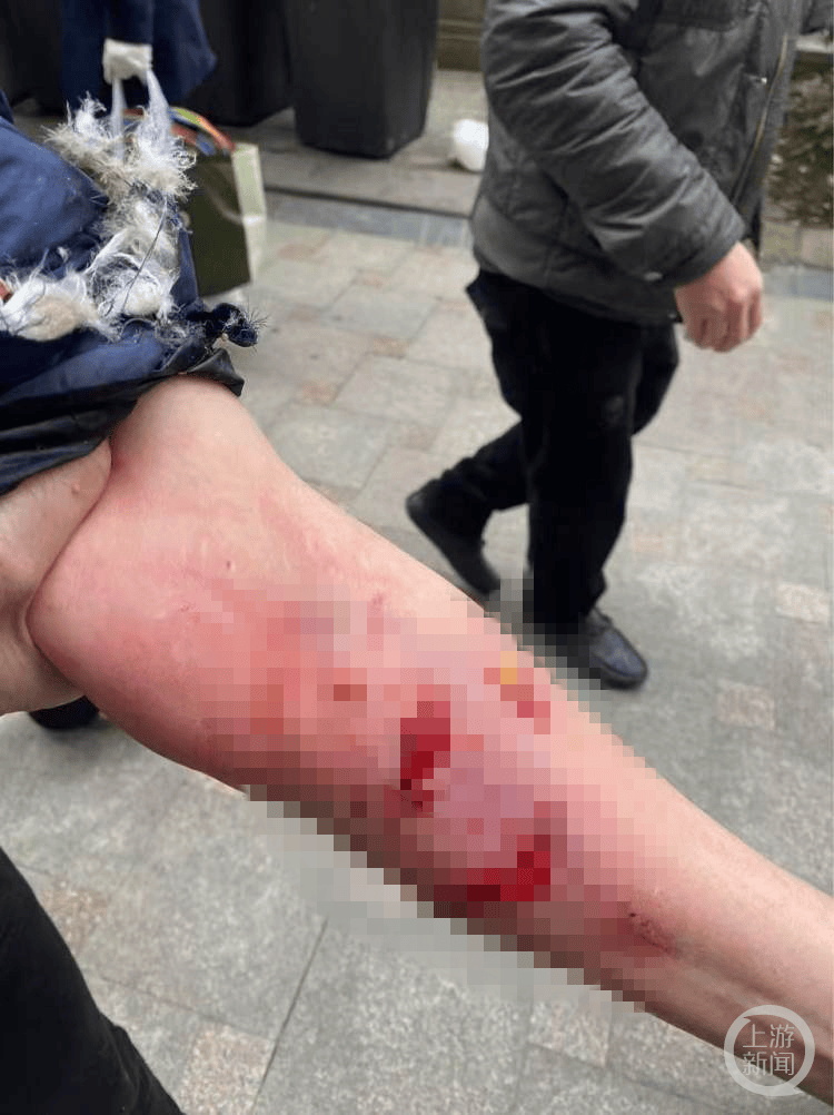 介绍个正网信用网址_成都一女子小区电梯内被狗咬伤介绍个正网信用网址，警方称肇事犬只已被控制