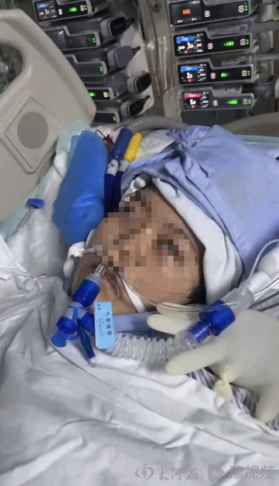 如何代理皇冠信用网
_22岁美甲师手术成功却在复苏室脑死亡如何代理皇冠信用网
,家属称缺氧30分钟监护医生未察觉,医院回应