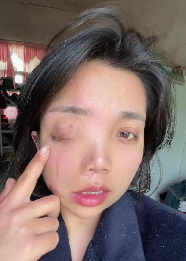 新版hga030_安徽女子左眼失明新版hga030，办理残疾人证被拒？残联：双眼残疾可办理