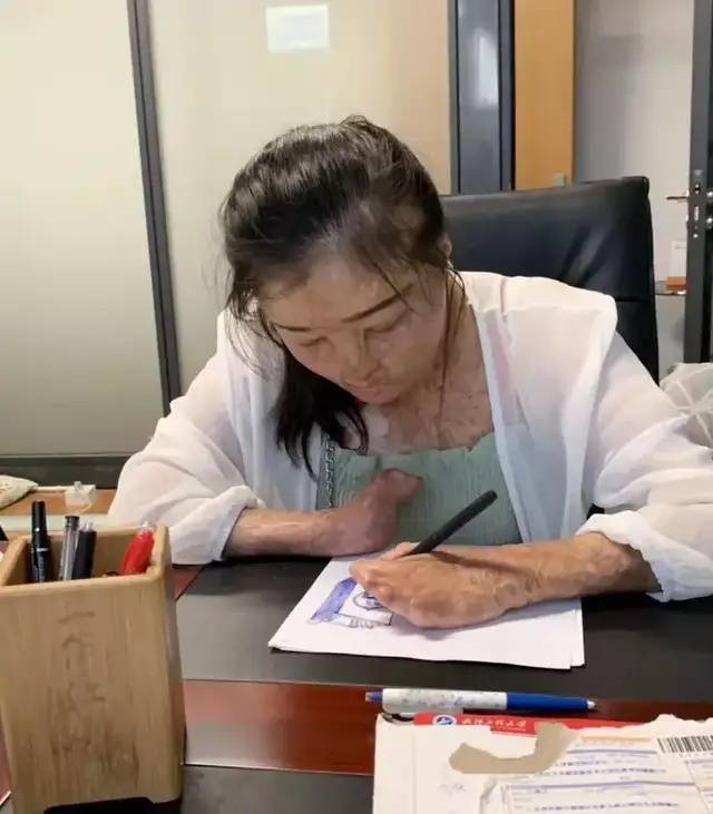 足球平台系统出租
_全身95%烧伤女孩订婚了足球平台系统出租
,与未婚夫同年同月同日生,本人发声:请大家祝福我们吧