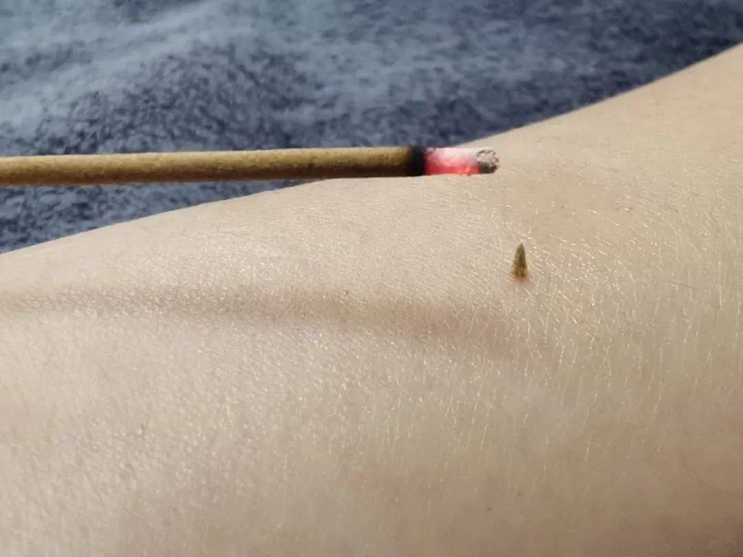 皇冠信用网登2代理_醒来“天塌了”皇冠信用网登2代理！深圳一女子眼睛闭不上、嘴巴漏水！这些错误很多人会犯