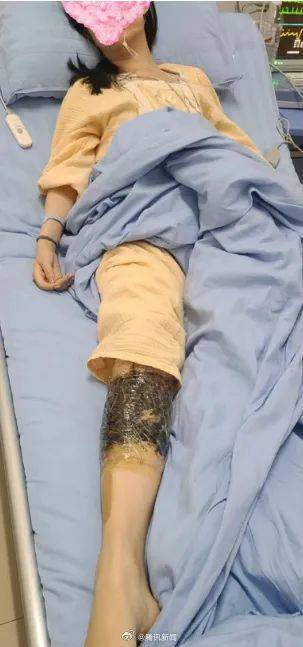 新2網址_女子在云南被银环蛇咬伤打了十多支血清新2網址，自称2年后仍有后遗症：头晕脸麻，没想到恢复得这么慢