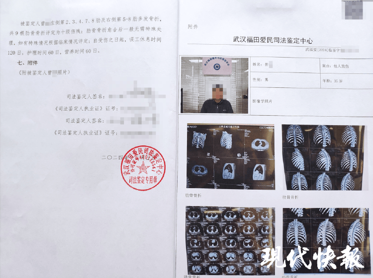 波尔图_湖北一男子称被交警打断9根肋骨未立案波尔图，警方回应