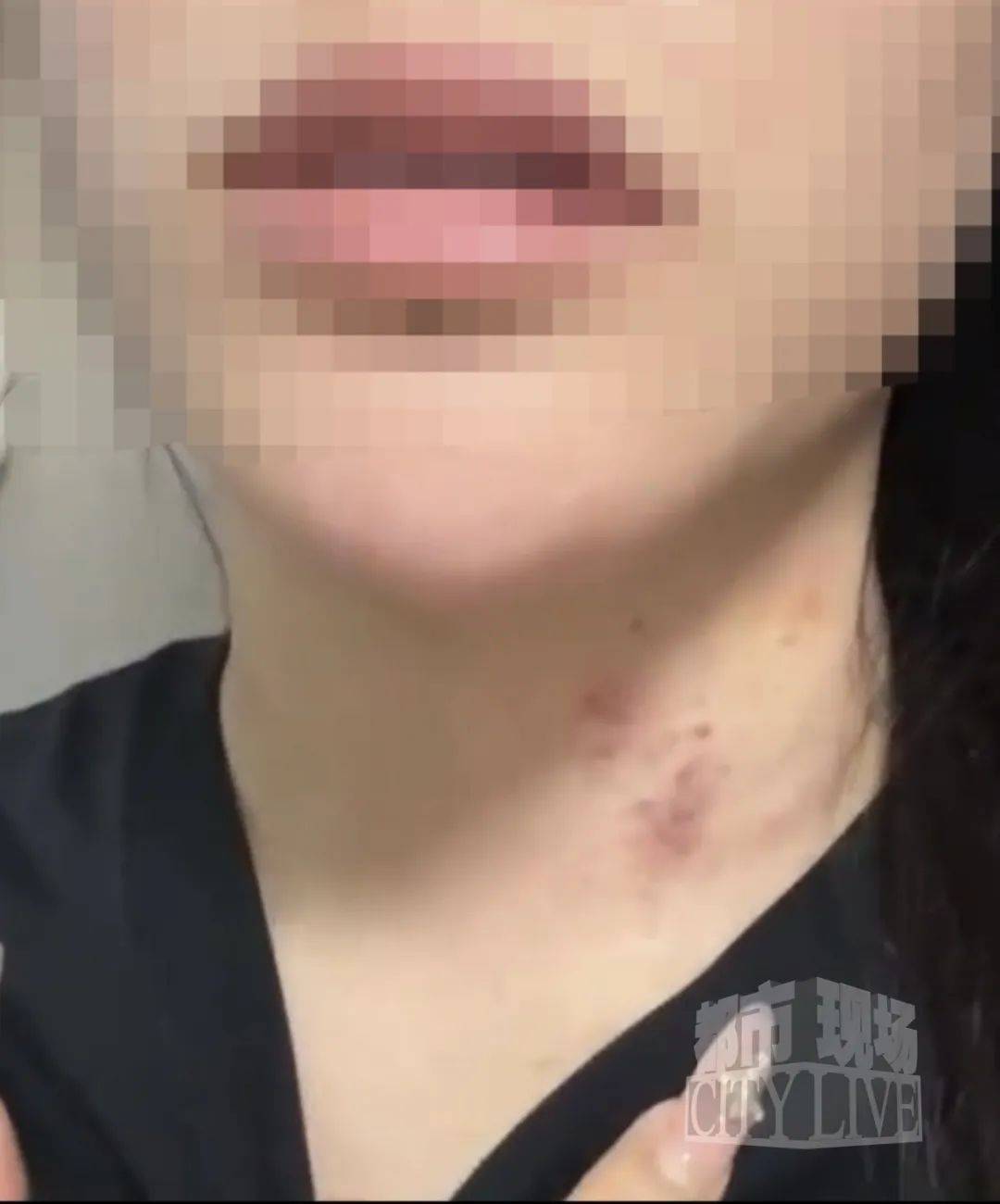 皇冠信用盘如何注册_湖南衡阳29岁女子疑被男友施暴后从25楼跳下身亡 男友徐某此前还刺激说：“你放心皇冠信用盘如何注册，她不会去死的”