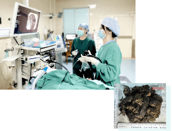 苏格兰超级联赛_发现1例苏格兰超级联赛,15岁女孩确诊!