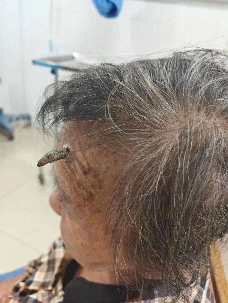 捷克甲组联赛 _太突然！上海98岁阿婆拿起剪刀捷克甲组联赛 ，一把剪掉头上的“角”！网友：对自己够狠