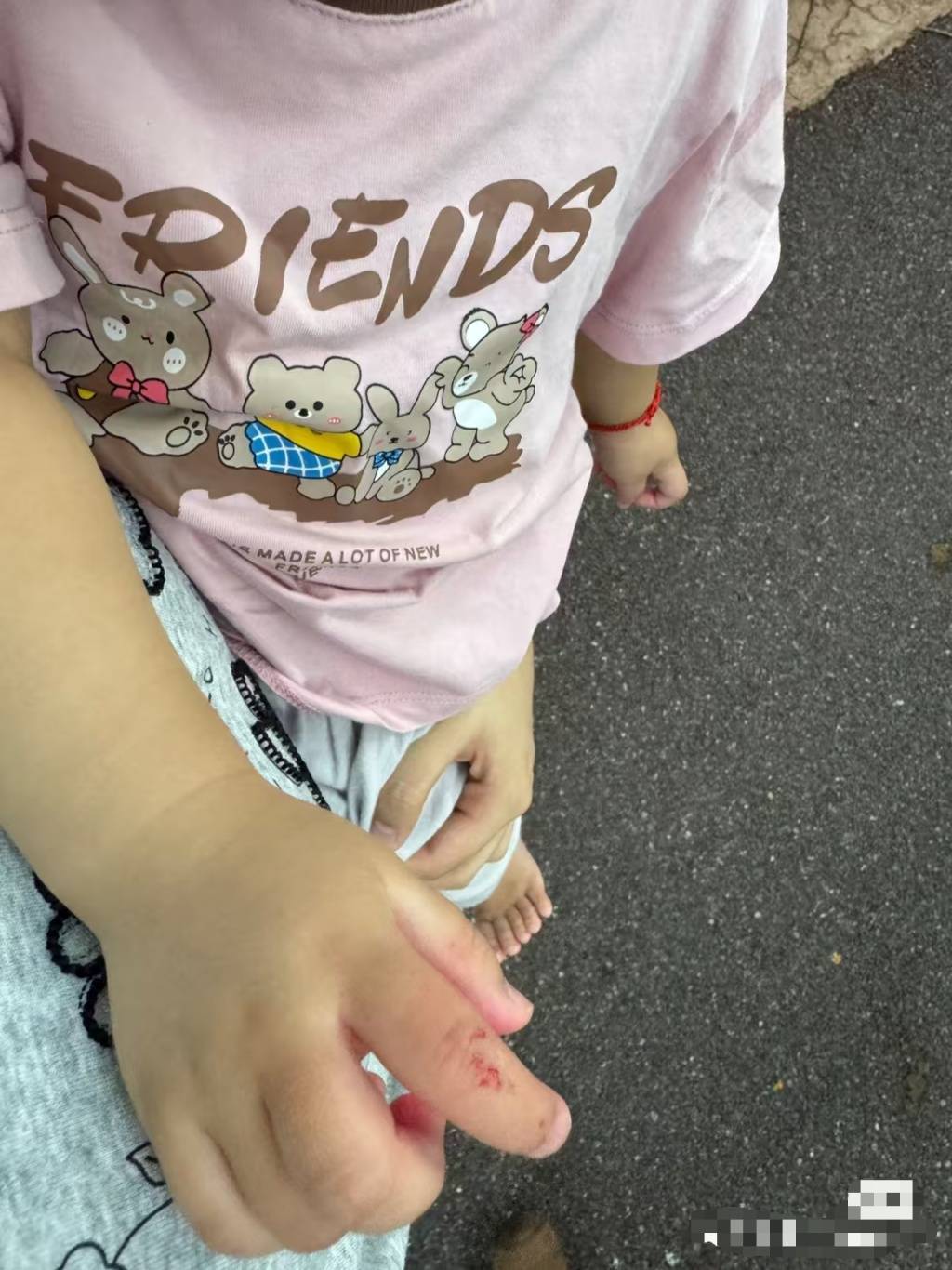 信用网如何申请_黑猩猩丢石头砸伤1岁幼童信用网如何申请，广州长隆回应