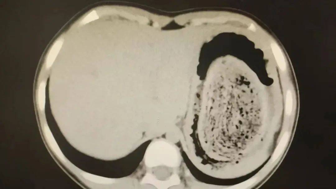 皇冠登3代理出租_发现一例皇冠登3代理出租，10岁女孩确诊！已有多起病例，有人因羞耻感延误就医……