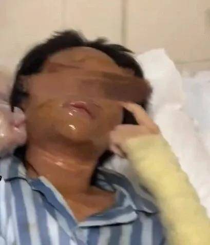 怎么开通皇冠信用網口
_女主播称遭伪装快递包裹炸伤怎么开通皇冠信用網口
,湖南警方通报