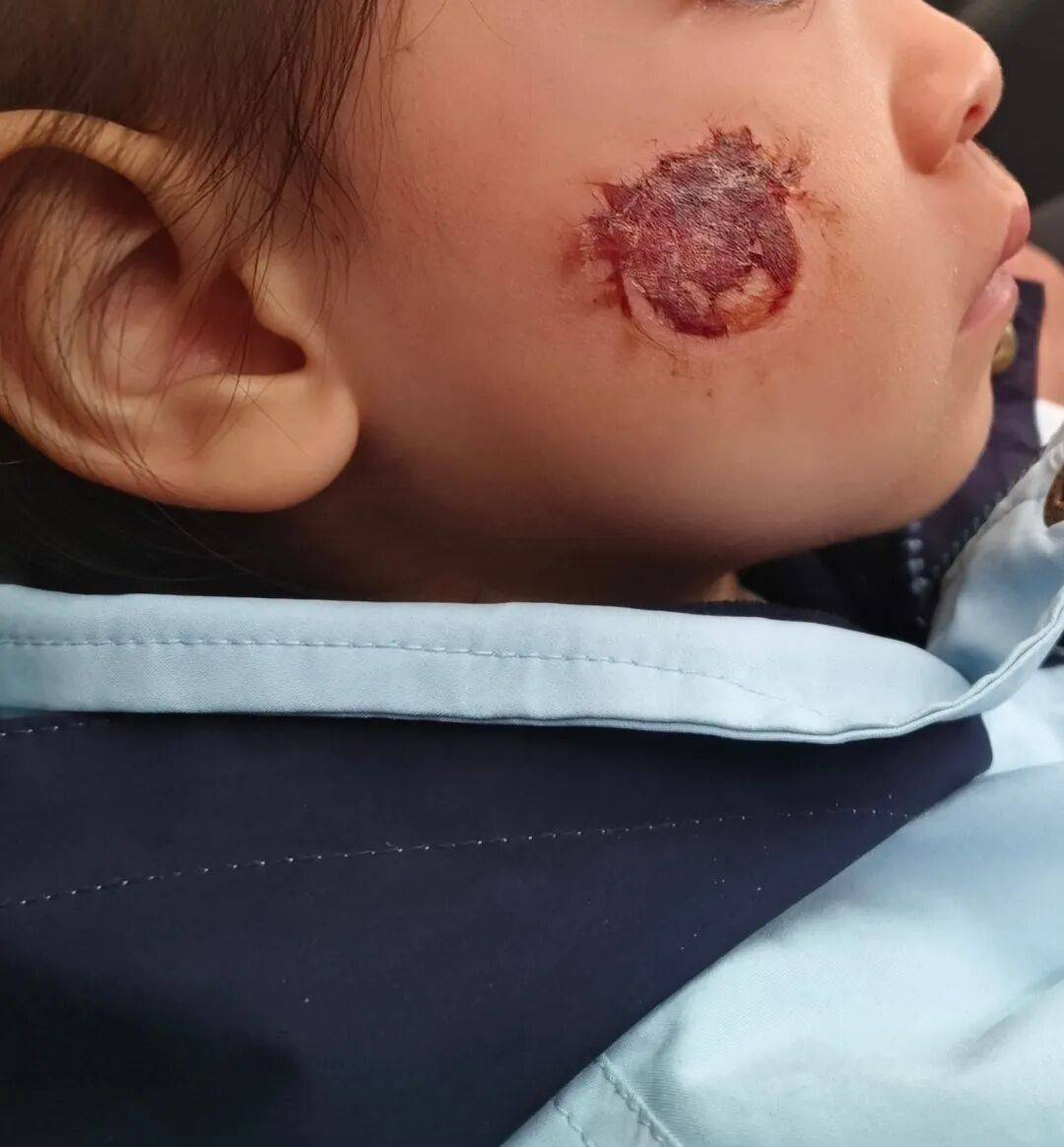 皇冠客服
_3岁女童脸部糜烂皇冠客服
,这东西很多人都在玩!紧急提醒