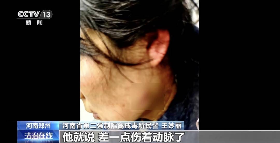 皇冠投注
_女警徒手夺刀皇冠投注
,脸上缝30多针:后怕但不后悔