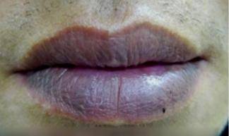 皇冠信用网登2_“感谢救我一命”32岁博主嘴唇发紫被粉丝催检查皇冠信用网登2,背上动态检测仪心脏停搏2次,最长3.1秒,医生:很危险,停搏不启动就叫猝死